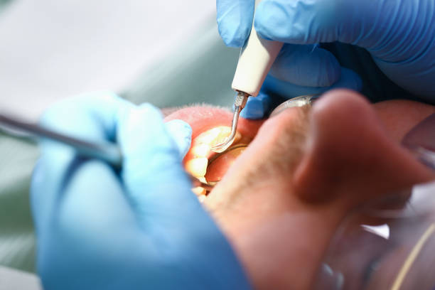 Best Urgent Tooth Repair  in Haskell, TX