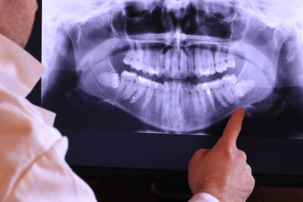 Best Dentist for Tooth Abscess  in Haskell, TX